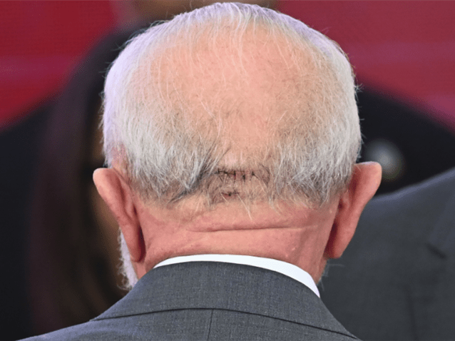 (img)