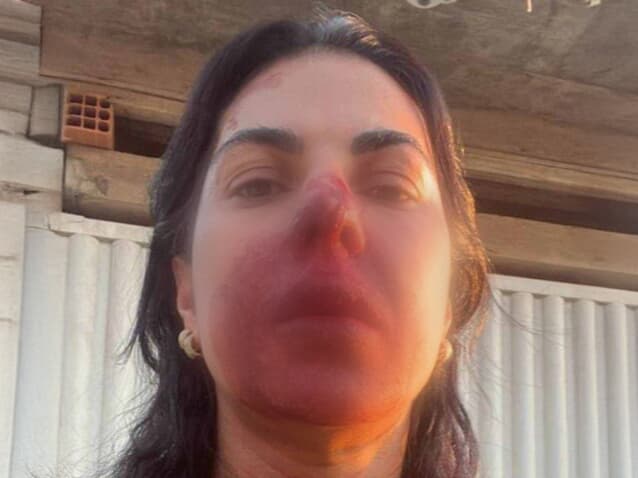 (img)