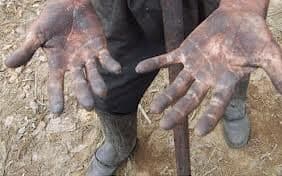 PEC 57A/ 1999 - PEC do Trabalho Escravo - Emenda Constitucional 81 - Qual será a definição de "trabalho escravo"?