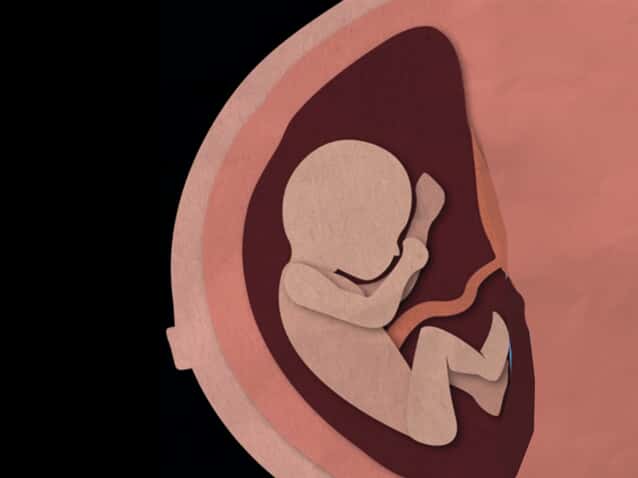 O erro do médico no sexo do feto e suas consequências jurídicas